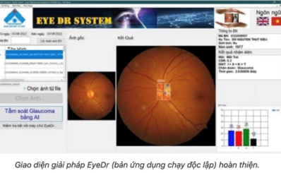 Bệnh viện Mắt TPHCM: Ứng dụng AI tầm soát bệnh glôcôm